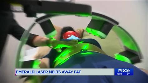 Emerald Laser Weight Loss Technology Melts Fat Pix11