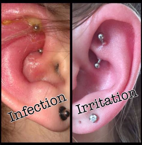 Maybe you would like to learn more about one of these? How do i know if my piercing is infected MISHKANET.COM