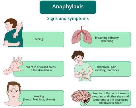Anaphylaxis Other Life Threatening Conditions First Aid Faculty