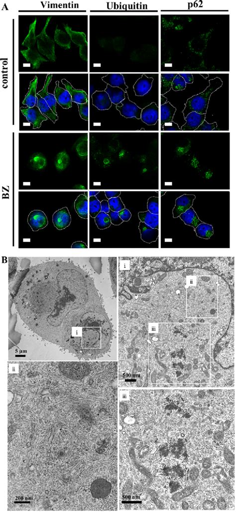 Figure 2 From Targeting Bortezomib Induced Aggresome Formation Using