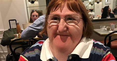 Disabled Blogger Told She Was Too Ugly For Selfies Keeps On Posting