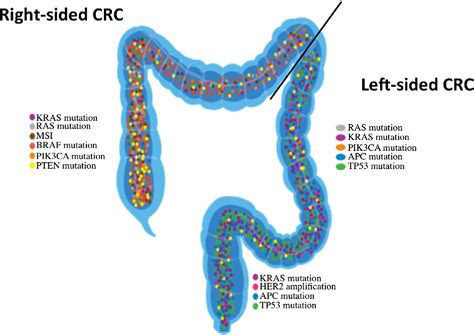 Colorectal Cancer Types