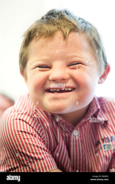 Child Downs Syndrome Stock Photo Alamy
