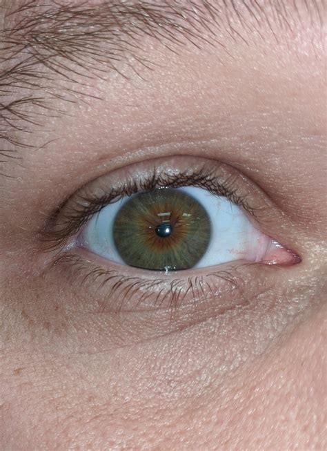 Are My Just Hazel Or Is This Central Heterochromia Rheterochromia