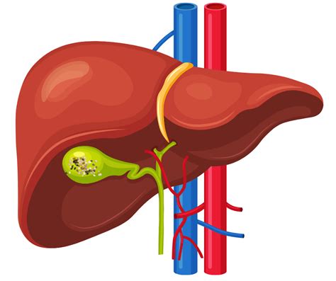 Understanding Gall Bladder Stones Wellness Homeopathy