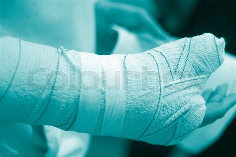 Doctor Patient Plaster Cast Stock Image Colourbox