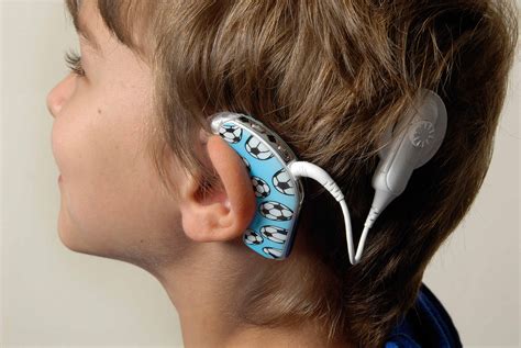 Cochlear Implant Popularity In Brazil Increases Sales For Cochlear Med