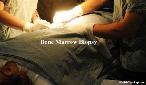 Bone Marrow Biopsy Test Procedure And Results Health Checkup