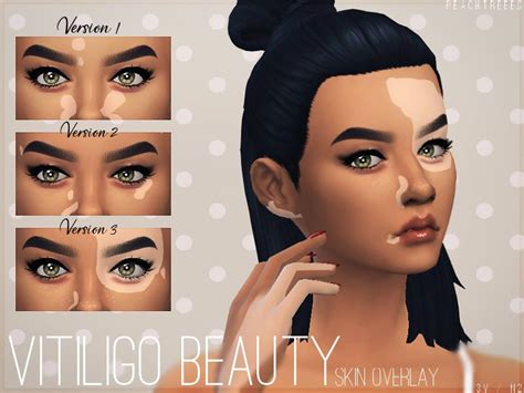 Sims 4 Viltiligo Cc And Mods Selected Snootysims