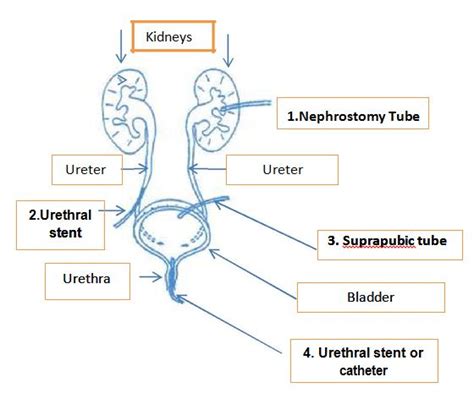 Caring Of Urinary Drainage Tubes Or Catheters