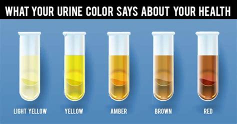 What Does Colors Of Urine Tells About The Health