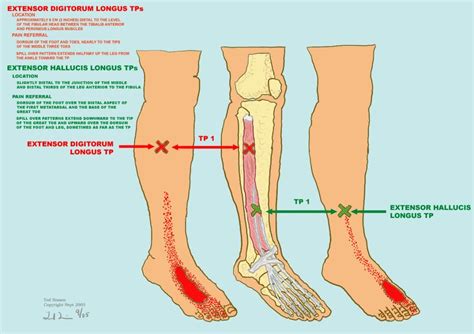 A controlled passive method, as well as the. extensor+digitorum+longus | 22 EXTENSOR DIGITORUM LONGUS ...