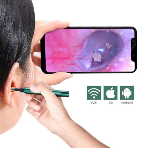 Smart Ear Remover Pro Ear Cleaning Kit With Camera In 2021 Ear