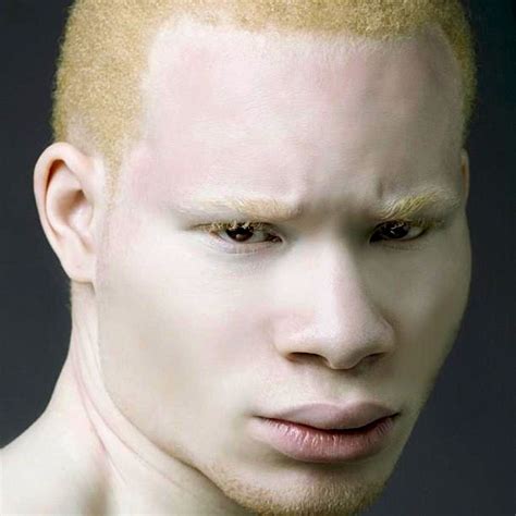 Pin By Ilon Ilona On Stay Human Interesting Faces Fascinating Albino