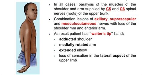 Brachial Plexus Injuries Flashcards Quizlet