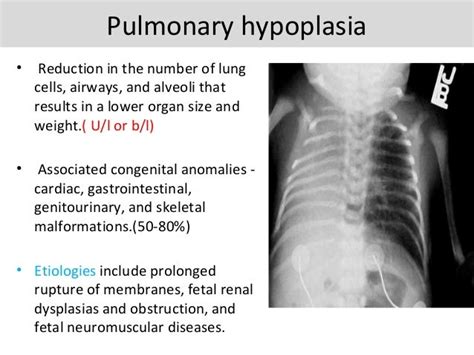 Development Of Lung