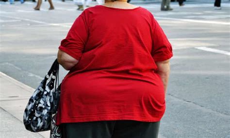 morbidly obese people in england should get flu jab obesity the guardian