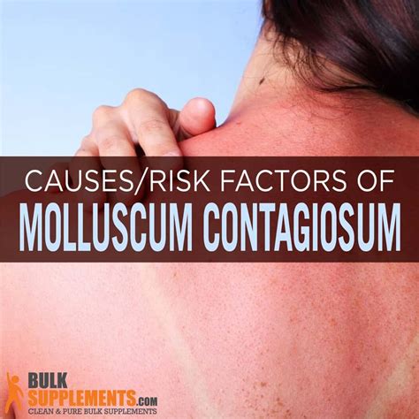 Molluscum Contagiosum Symptoms Causes Treatment