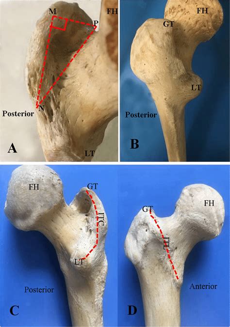 The Posterosuperior View Of A Cadaveric Specimen Of The Hip Shows The