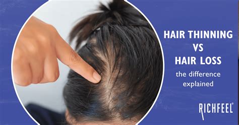 Hair Thinning Vs Hair Loss The Difference Explained Richfeel