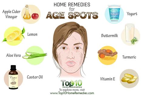 Home Remedies For Age Spots Top 10 Home Remedies
