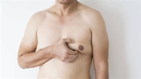 Gynaecomastia Male Breast Reduction Dr David Colbert