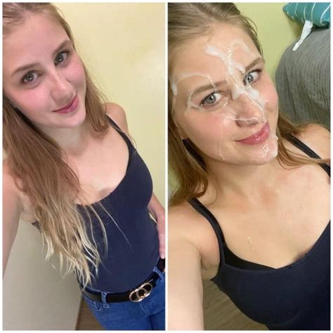 Clothed Beforeafter Facial Fabba120