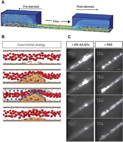 The Shear Activated Nanotherapeutics A A Microfluidic Model Of The