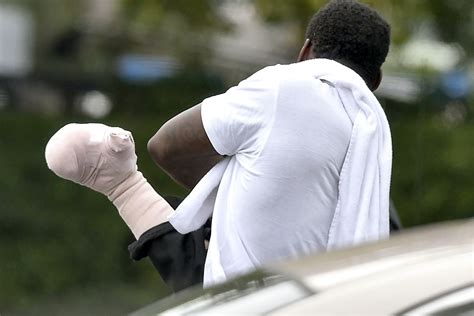 Jpp Seen In Bandages Sling For First Time Since Hand Injury