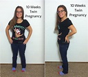 10 Week Pregnant Belly Pictures Twins - pregnantbelly