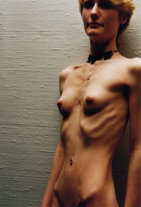 ANOREXIC NUDE