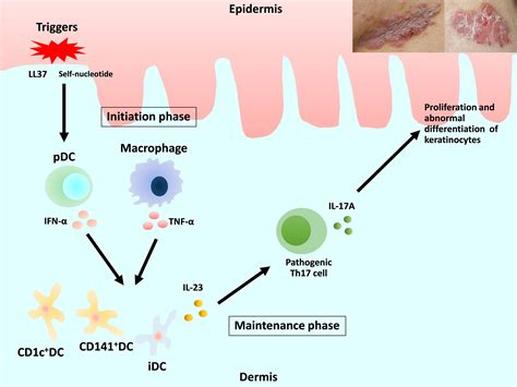 Frontiers Dendritic Cells And Macrophages In The Pathogenesis Of