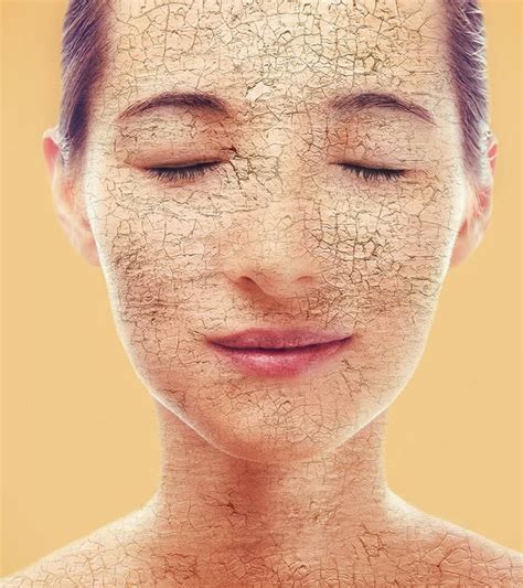38 Home Remedies To Get Rid Of Dry Skin On The Face Dry Cracked Skin