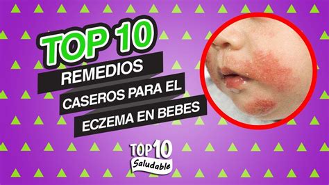Top 10 Remedios Caseros Para El Eczema En Bebes Vive Saludable Youtube