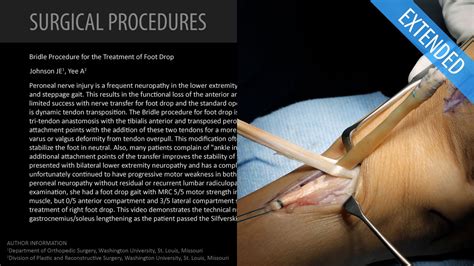 Bridle Procedure For The Treatment Of Foot Drop Extended Feat Dr