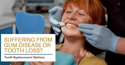 Suffering From Gum Disease Or Tooth Loss Tooth Replacement Options