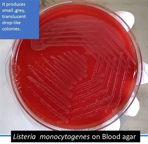 Listeria On Blood Agar Introduction Morphology Culture Characteristics