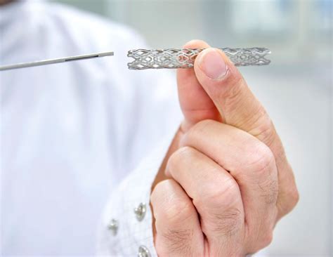 Global Peripheral Vascular Stents 6 Trends You Should Be Aware Of
