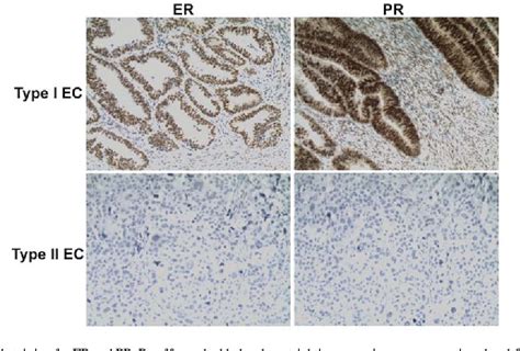 figure 1 from mir 449a functions as a tumor suppressor in endometrial cancer by targeting cdc25a