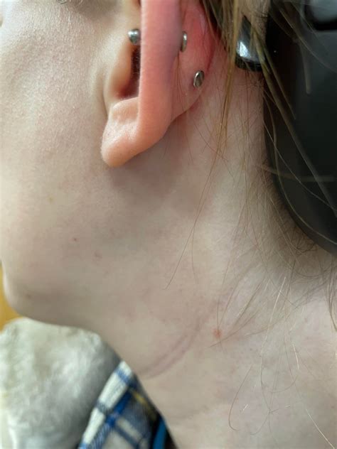 swollen helix piercing should i ask piercer to get a slightly longer bar conch due for