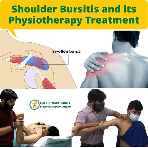 Shoulder Bursitis And Its Physiotherapy Treatment Elite Physio
