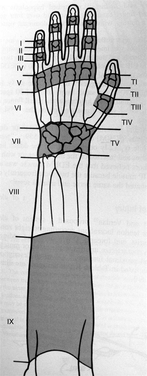 Extensor Tendon Injuries Journal Of Hand Surgery