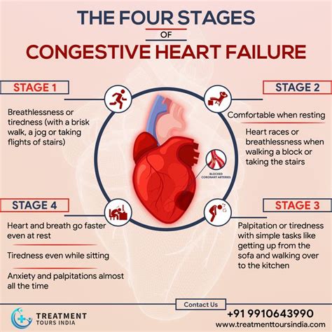 Stages Of Congestive Heart Failure In Congestive Heart Failure