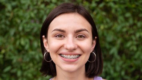 Comprehensive Orthodontics And How To Maintain New Braces