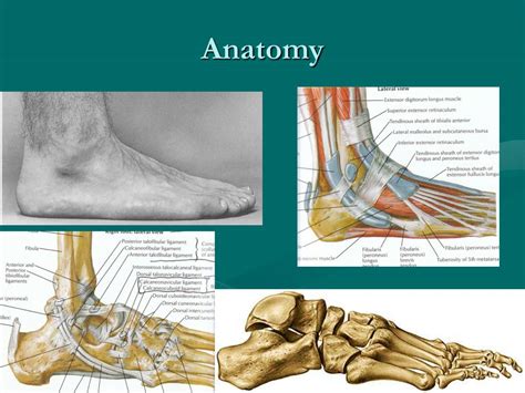 Ppt Ankle And Foot Common Acute Injuries Powerpoint Presentation