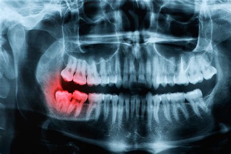 Simple Science: How to Make a Volcano with Kids
