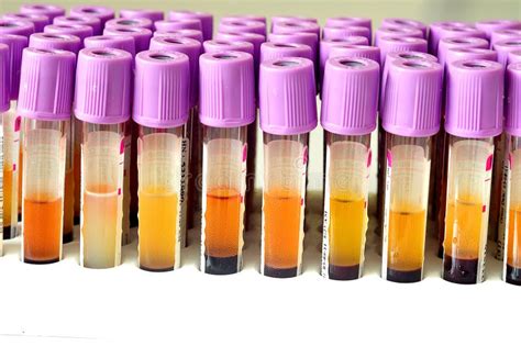 Blood Sample Stock Image Image Of Chemistry Laboratory 20637075