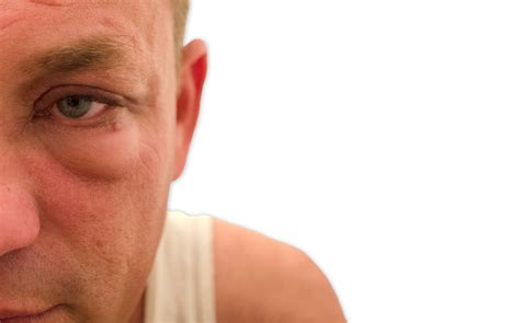 Überprüfen sie die übersetzungen von 'innere augenwinkel' ins englisch. Uveitis posterior: diagnóstico y tratamiento