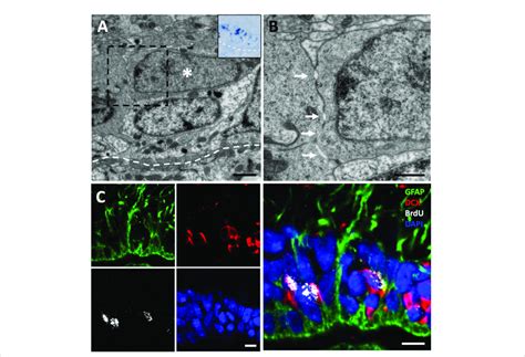 3 H Thymidine Incorporating Neuroblasts Are Found In The Ventricular
