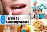 Treatment For Dry Socket After Tooth Removal Pictures